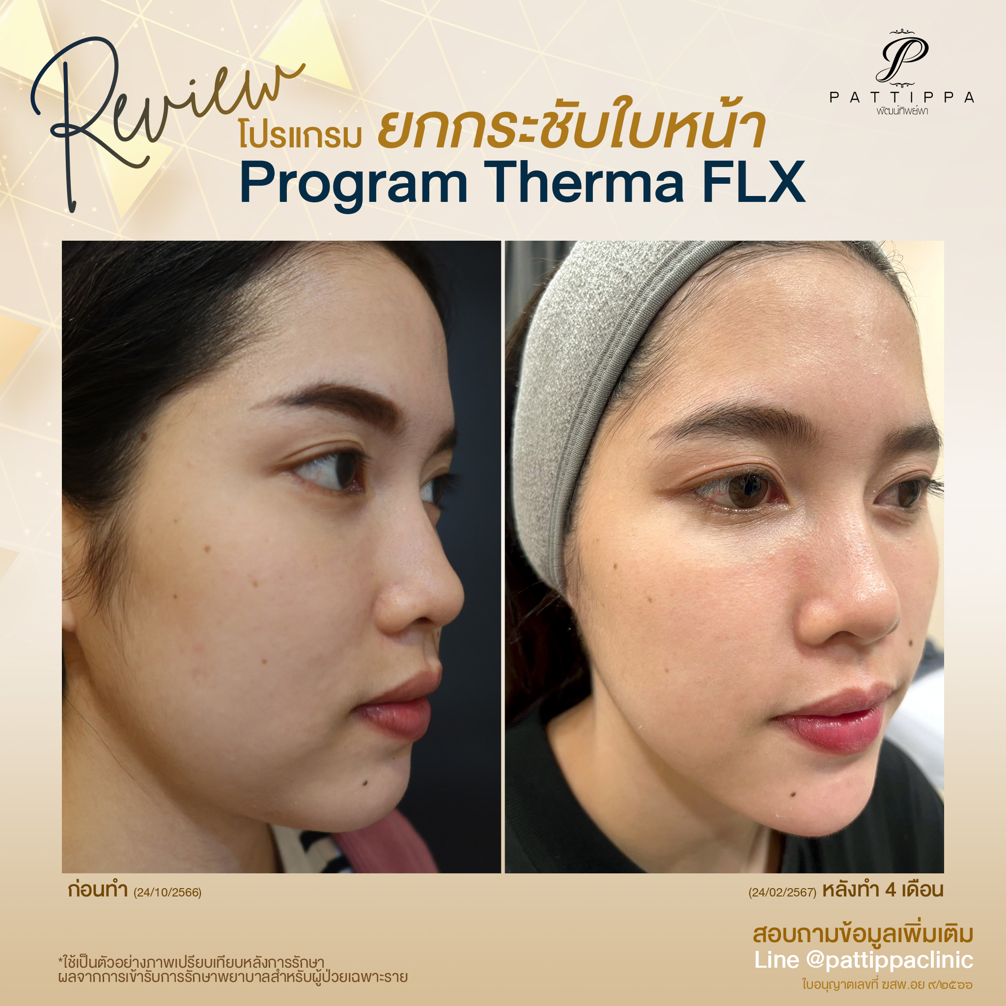 Patt_review_thermage_002