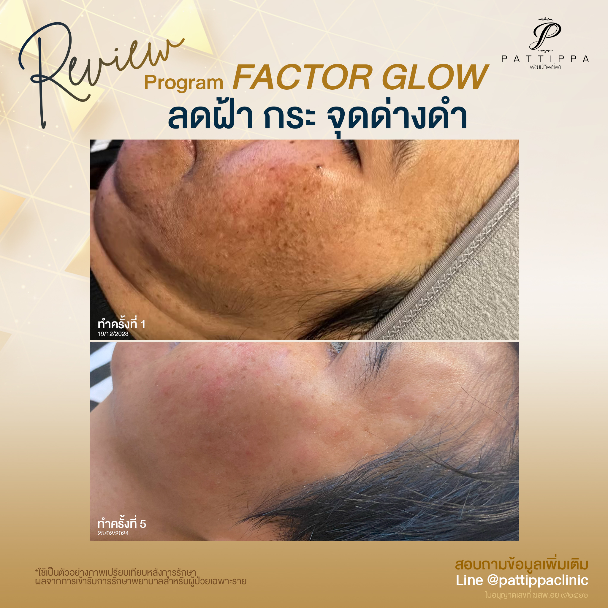 Patt_review_factor-glow_001-1