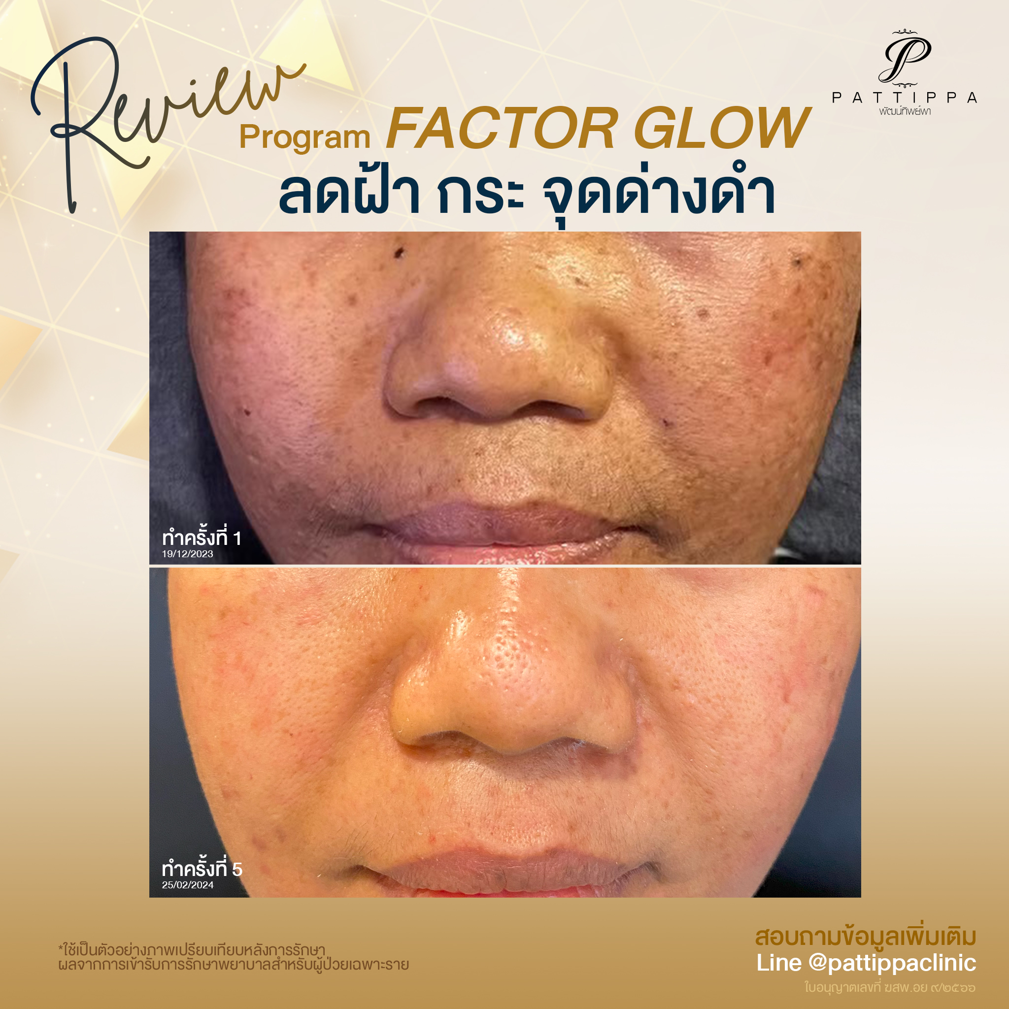 Patt_review_factor-glow_001