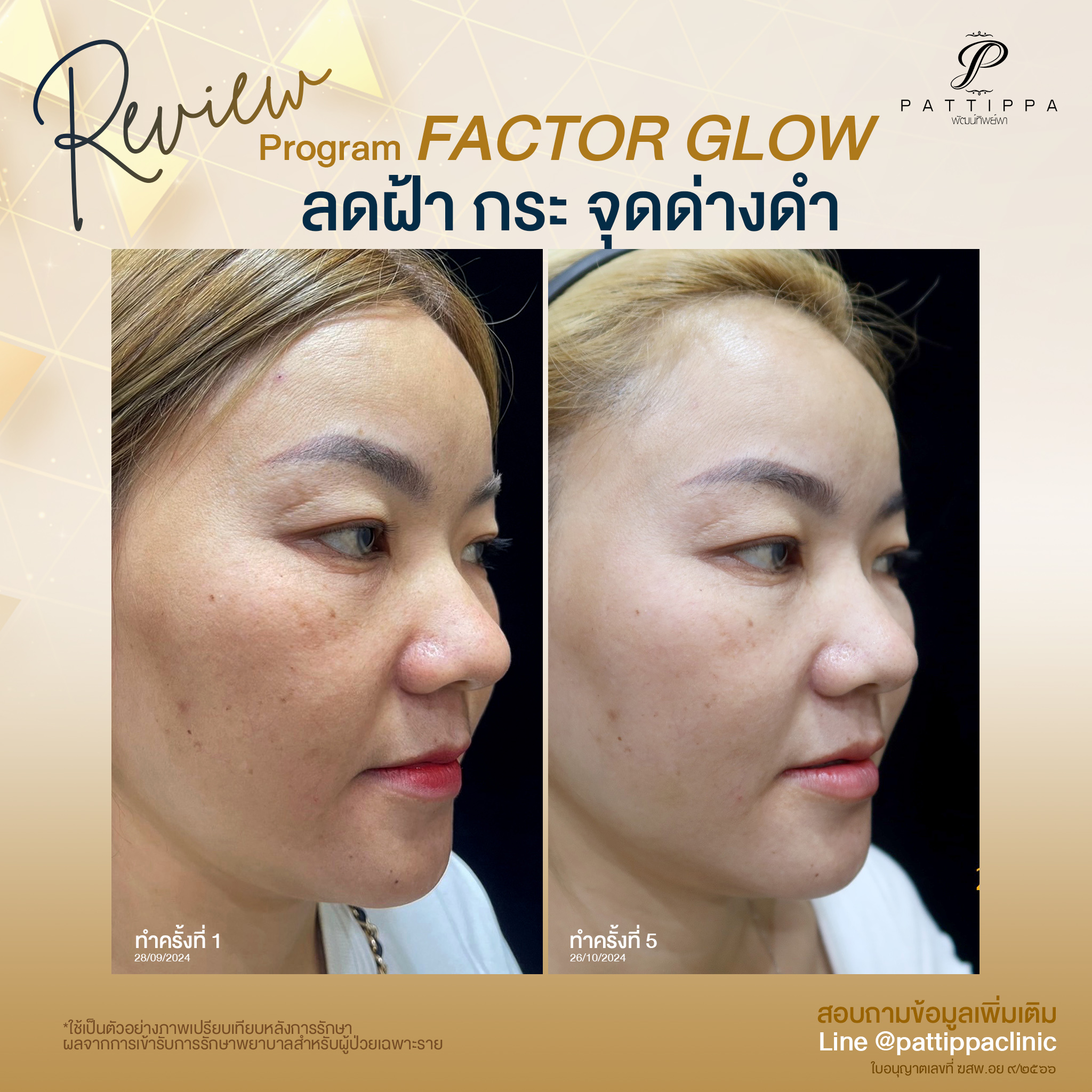 Patt_review_factor-glow_002-1