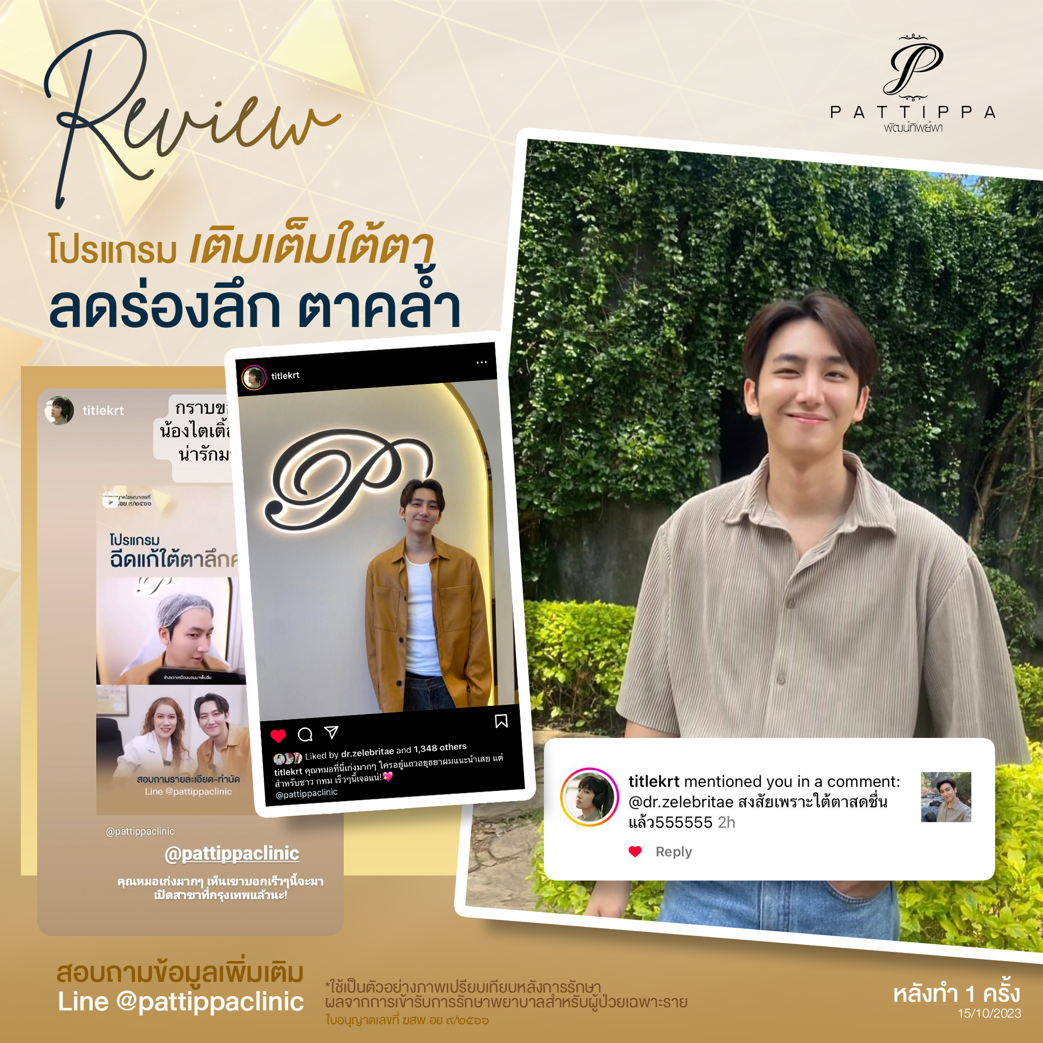 Patt_review_filler-eye_005