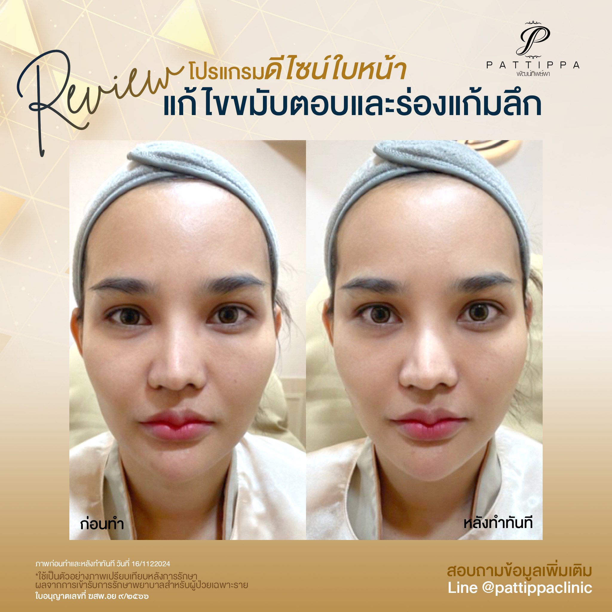 Patt_review_filler-face_019