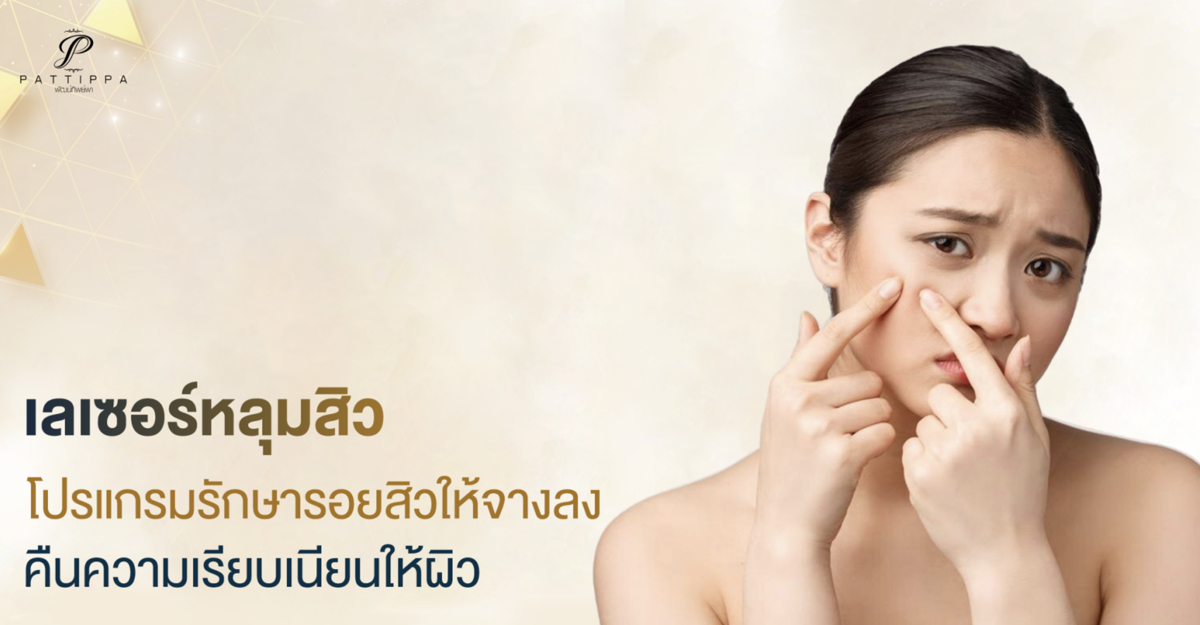เลเซอร์หลุมสิว โปรแกรมรักษารอยสิว ช่วยให้ผิวเรียบเนียนขึ้น
