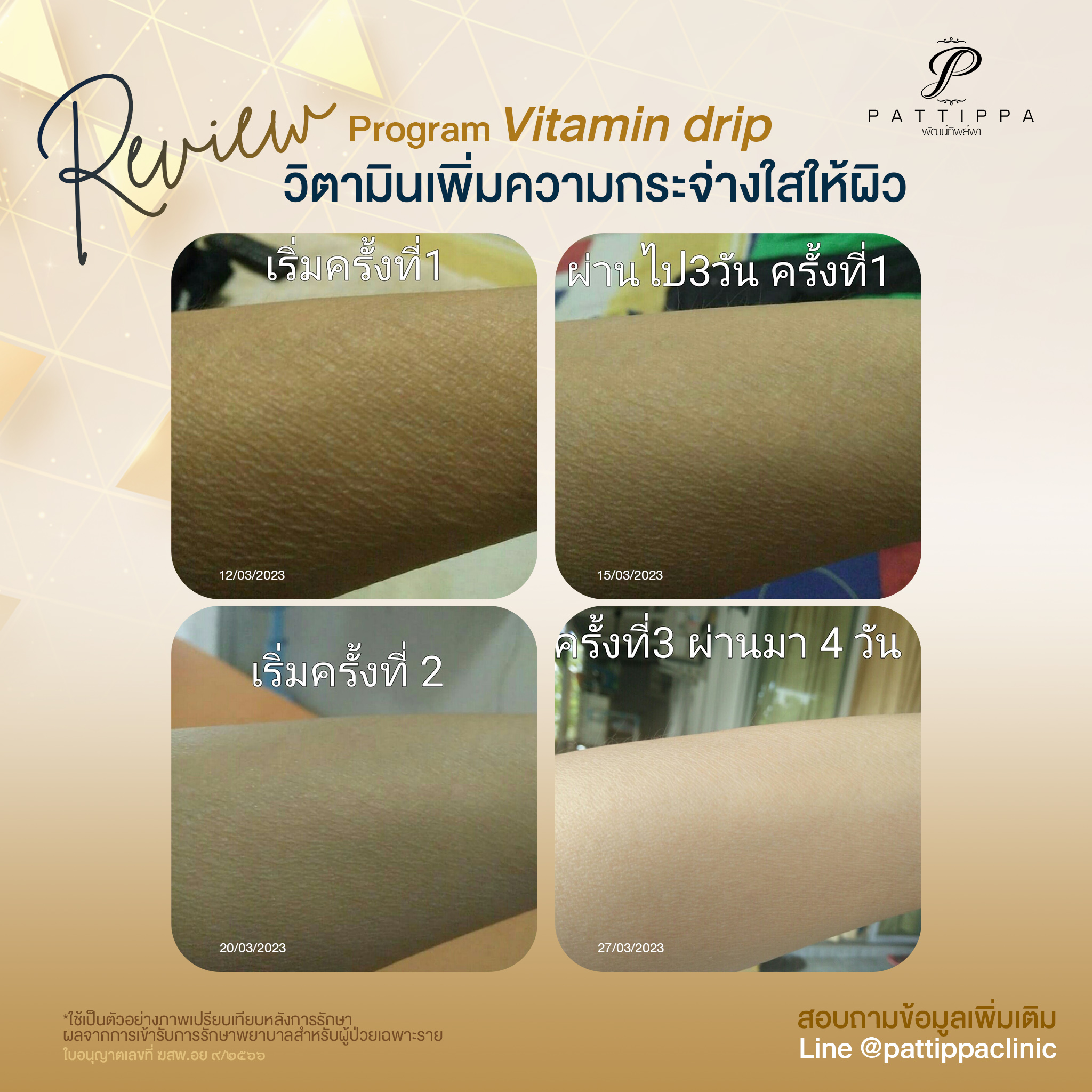 Patt_review_vitamin_001