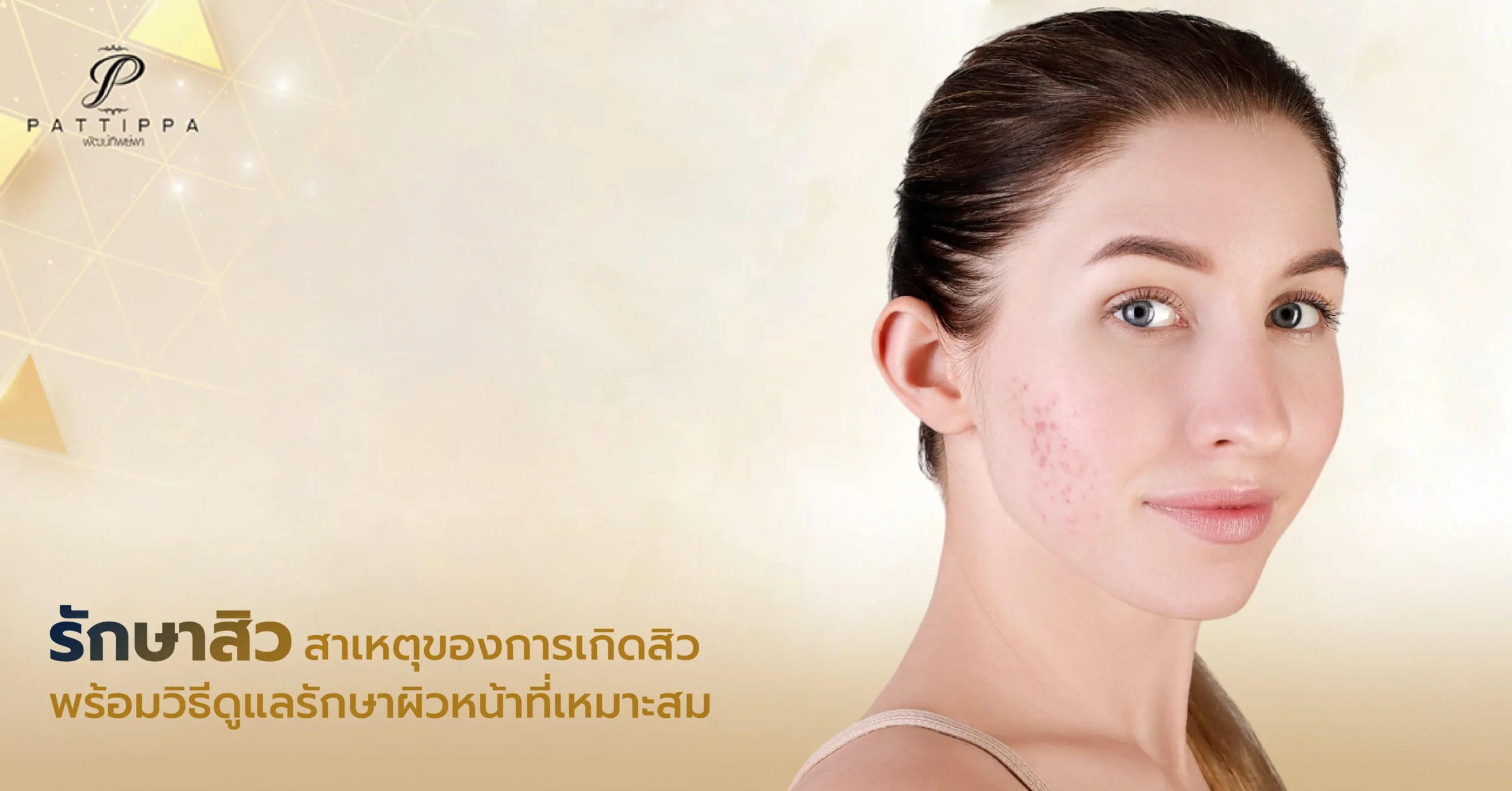 รักษาสิว สาเหตุของการเกิดสิว พร้อมวิธีดูแลรักษาผิวหน้าที่เหมาะสม
